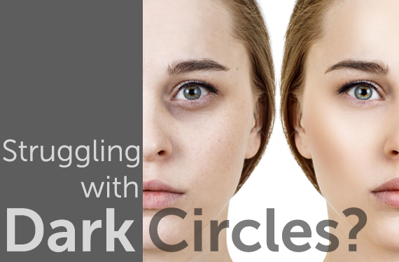 Stuggling with Dark Circles?